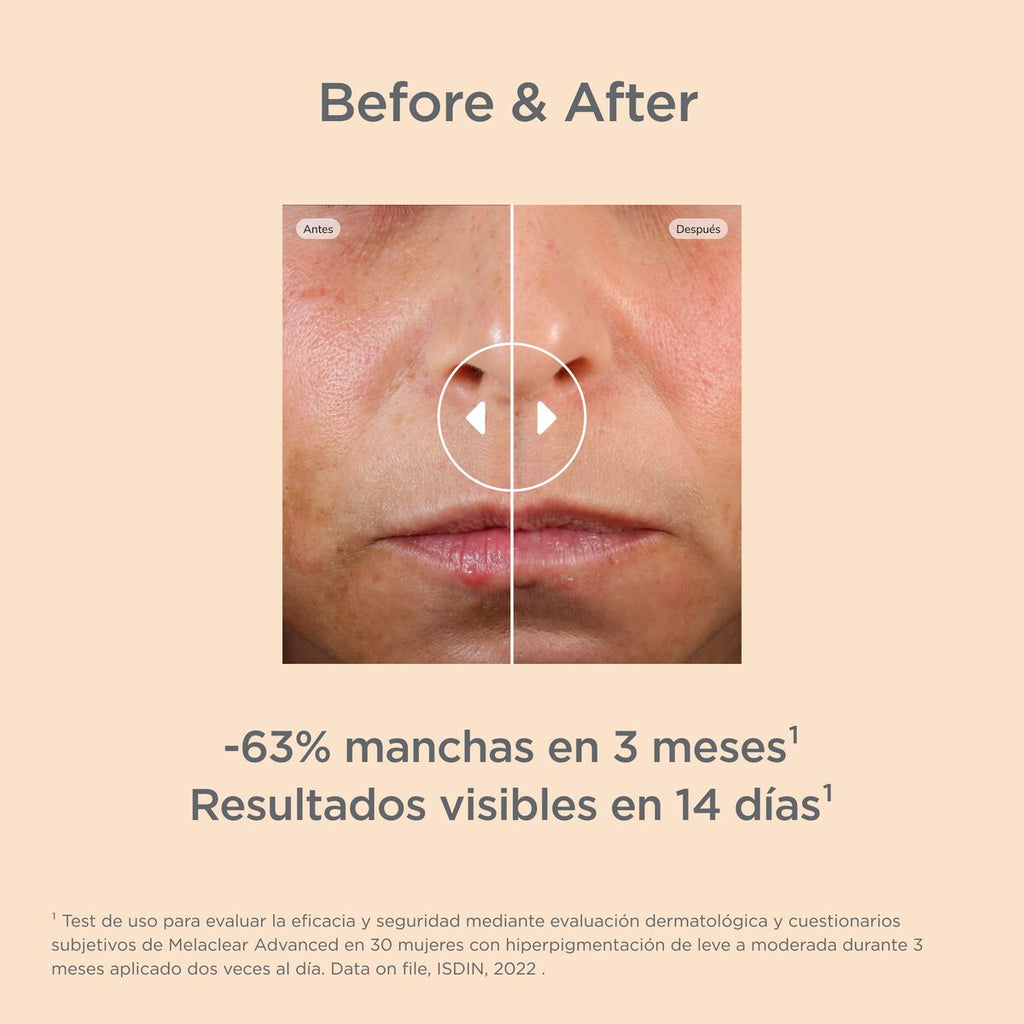 Melaclear Advance Serum - Isdin 30 ml